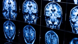 El plan del presidente de EE.UU., Barack Obama, para elaborar un mapa completo del cerebro humano y que contar&aacute; con la participaci&oacute;n del Pent&aacute;gono, agencias federales, cient&iacute;ficos y el sector privado provoc&oacute; hoy reacciones encontradas en ese pa&iacute;s.