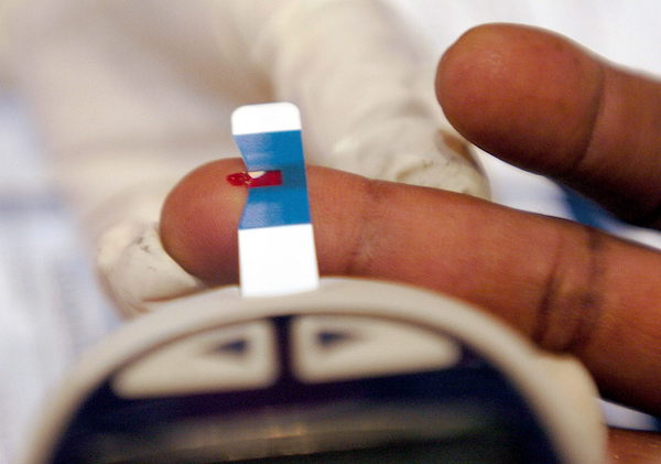 Muestras de sangre para conocer los niveles de azucar i