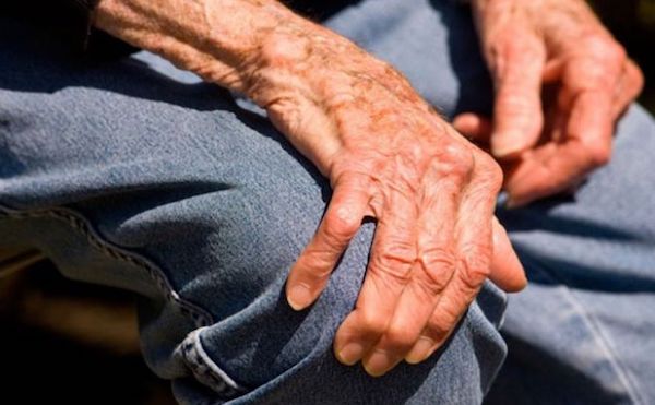 Los hispanos y los blancos son m&aacute;s propensos a padecer de la enfermedad de Parkinson en Estados Unidos, revela una investigaci&oacute;n divulgada hoy que adem&aacute;s indic&oacute; que hay ciertas zonas del pa&iacute;s en las que es m&aacute;s com&uacute;n la enfermedad.