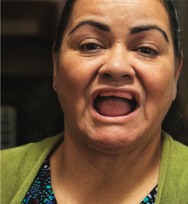 Historias personales reales son compartidas en la campaña contra el tabaquismo, no son actores pagados, como el caso de Felicita, una hispana de Florida que perdió 24 dientes a pesar de que dejó de fumar.