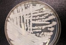 Alerta Hongo Candida Auris