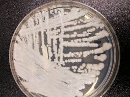 Alerta Hongo Candida Auris