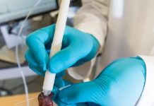 MasSpec Pen, herramienta creada con el fin de identificar el cáncer Un grupo de científicos e ingenieros de la Universidad de Texas en Austin ha creado una herramienta para identificar tejidos con cáncer. (foto twitter)
