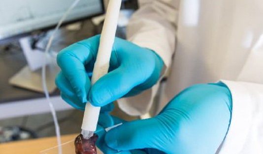 MasSpec Pen, herramienta creada con el fin de identificar el cáncer Un grupo de científicos e ingenieros de la Universidad de Texas en Austin ha creado una herramienta para identificar tejidos con cáncer. (foto twitter)