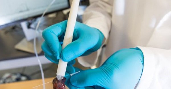Un grupo de científicos e ingenieros de la Universidad de Texas en Austin ha creado una herramienta para identificar tejidos con cáncer. (foto twitter)