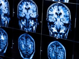 El plan del presidente de EE.UU., Barack Obama, para elaborar un mapa completo del cerebro humano y que contará con la participación del Pentágono, agencias federales, científicos y el sector privado provocó hoy reacciones encontradas en ese país.