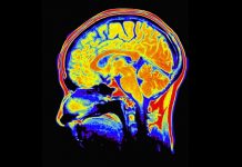 El presidente de EE.UU., Barack Obama, anunciará hoy una amplia iniciativa de investigación del cerebro que se pondrá en marcha el año próximo con 100 millones de dólares, informaron medios estadounidenses.