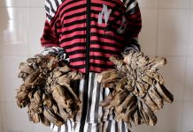 Fotografía de archivo con fecha de 1 de febrero de 2016 de Abul Bajandar, un paciente diagnosticado con epidermodisplasia verruciforme.