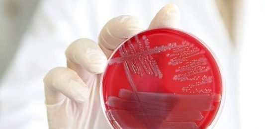 bacteria "E.coli"