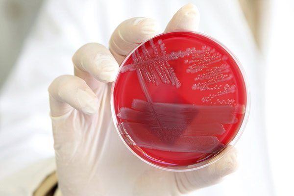 bacteria "E.coli"