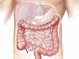 Obesidad y alcohol impulsan el aumento de las tasas de cáncer de intestino en los adultos El hígado graso es una enfermedad "silenciosa" que, sin un diagnóstico oportuno, puede derivar en cirrosis o cáncer de hígado y llevar a la muerte