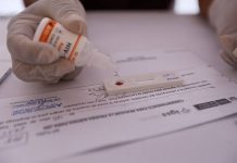 Aumenta frecuencia de casos de VIH en población menor de 30 años La reducción a nivel mundial alcanzó, en los mismos años, 14 % entre la población de entre 15 y 19 años y 18 % entre los jóvenes en edades de 20 a 24 años.
