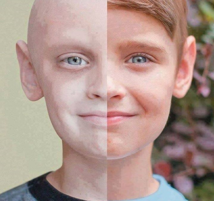 Quienes han padecido alg&uacute;n tipo de c&aacute;ncer y han logrado sobrevivir m&aacute;s de cinco a&ntilde;os, aseguran que los estragos que deja la enfermedad van desde la falta de autoestima hasta dificultades econ&oacute;micas, pero la &uacute;nica manera de salir adelante es la actitud.