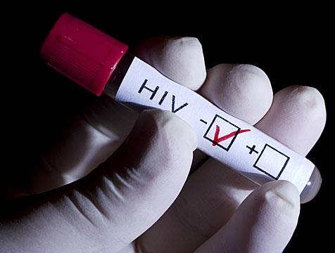Cada tres minutos, una persona de entre 16 y 19 años contrae este virus en algún lugar del mundo, una situación a la que es difícil poner fin si, según ONUSIDA