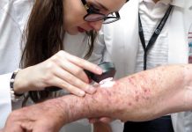 Los pacientes de cáncer de piel tienen más riesgo de desarrollar otros carcinomas como el cáncer de mama, colon y próstata. (Foto de twitter)