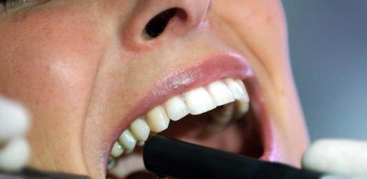 La mala salud bucal está relacionada con la alta presión arterial, según afirma una investigación presentada hoy por la Asociación Estadounidense del Corazón (AHA).