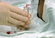 Pruebas de sangre para detectar cáncer generan esperanza, pero también preocupación El diagnóstico oportuno, el acceso a pruebas genéticas, a trasplante de médula ósea y a las nuevas terapias son los grandes retos que tiene Latinoamérica para tratar las leucemias agudas. (Foto de twitter)