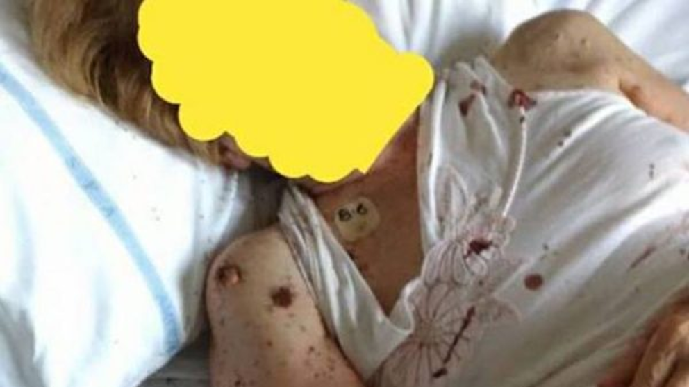 Los especialistas han precintado la habitaci&oacute;n, han desinfectado la zona y los pacientes han sido transferidos a otras secciones.