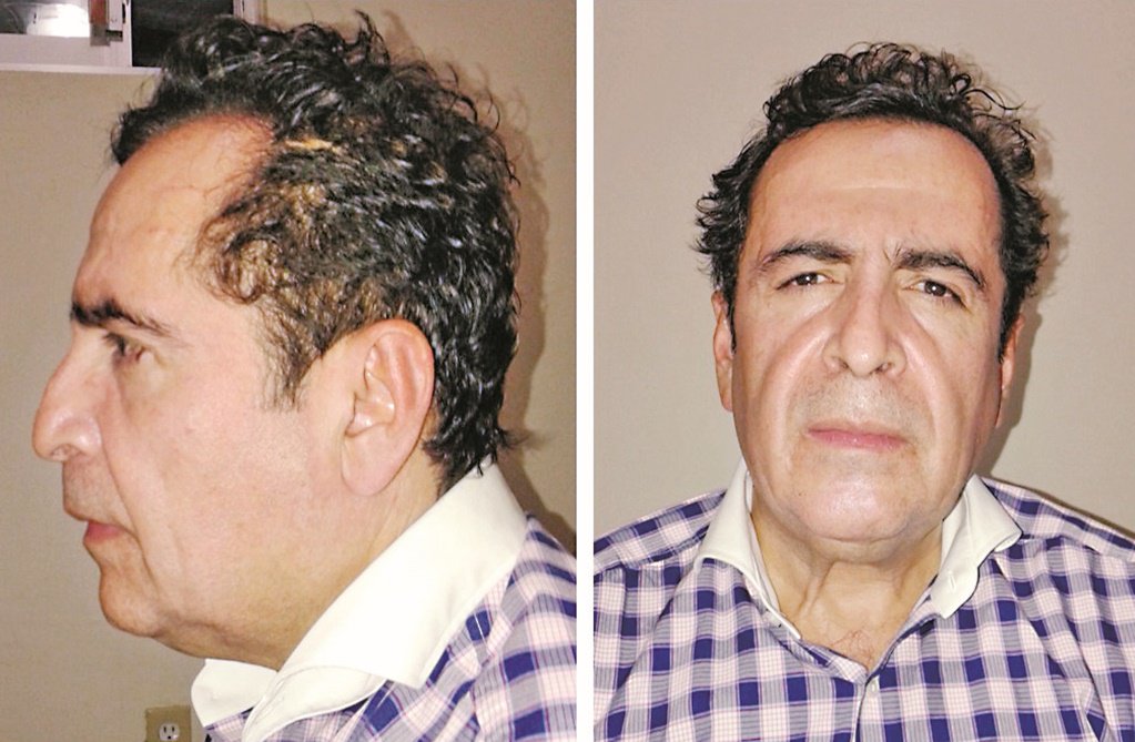 Héctor Beltrán Leyva, preso desde 2014 y que murió de un paro cardíaco, falleció cuando le notificaron que iba a ser extraditado para testificar en Nueva York