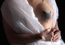 Fotografía de archivo de una mujer que muestra una cirugía reconstructiva.