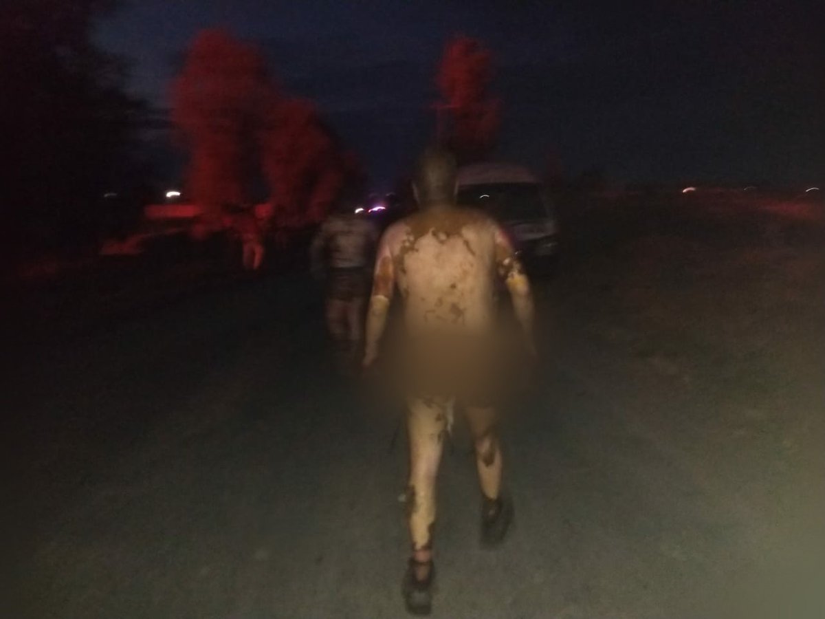 Un total de 51 personas siguen hospitalizadas en M&eacute;xico, algunas de ellas en estado muy cr&iacute;tico, tras la explosi&oacute;n en una toma clandestina.