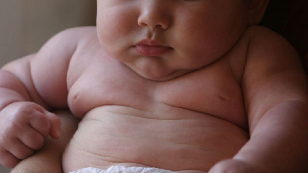Los niños con obesidad tendrían que ir al psiquiatra, pues su condición de salud física se asocia a problemas de salud mental como el trastorno por atracón