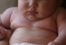Estado mexicano de Nuevo León ocupa primer lugar mundial en obesidad infantil Los niños con obesidad tendrían que ir al psiquiatra, pues su condición de salud física se asocia a problemas de salud mental como el trastorno por atracón