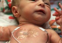 Científicos desarrollan sistema de monitoreo inalámbrico para recién nacidos Los sensores, se adhieren a la piel de los niños mediante parches, resultan además menos lesivos para los neonatos.