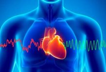 La estenosis aórtica, una condición que obstruye el flujo sanguíneo del corazón al cuerpo, eleva el riesgo hasta en 34 % de que los pacientes sufran una muerte súbita