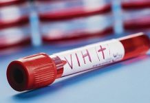 Falta de diagnósticos y tratamientos provocan nuevos contagios de VIH Cerca del 80 % de los nuevos casos se dieron por contagio de un 40 % de quienes no sabían que tenían el virus.
