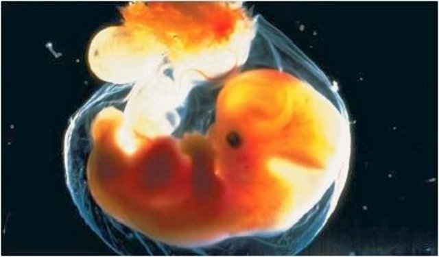 Georgia aprob&oacute; un proyecto de ley que prohibir&iacute;a el aborto una vez que se pueda escuchar el latido del coraz&oacute;n del feto.