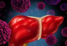Tasas de cáncer de hígado de mexicanos aumentan con cada generación en EEUU La incidencia de cáncer de hígado es mayor en hombres que en mujeres, y ahora un grupo de científicas españolas ha encontrado una explicación a esta característica