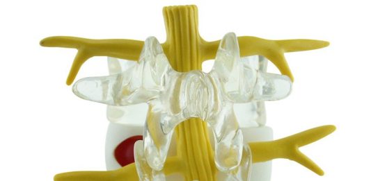 La electroestimulación y los ejercicios de Williams podrían ser eficaces para disminuir el dolor secundario de hernia lumbar.