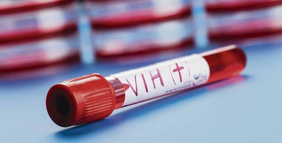 De acuerdo con cifras oficiales, en México 220.000 personas viven con VIH de las cuales solo el 64 % saben de su estado.