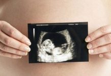 El Senado de Illinois aprueba una ley que fortalece el derecho al aborto La futura nueva ley estatal suplantará a la adoptada en 1975, y elimina la necesidad de consentimiento del cónyuge.