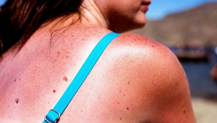 Una combinaci&oacute;n de tres drogas ha sido probada como nueva terapia "efectiva" para combatir un tipo de melanoma.