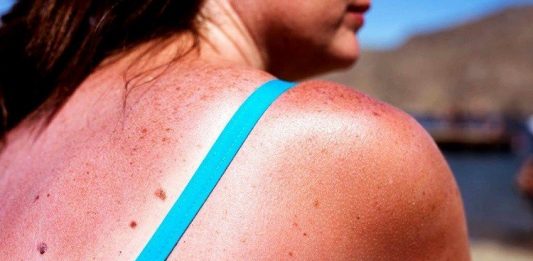 Una combinación de tres drogas ha sido probada como nueva terapia "efectiva" para combatir un tipo de melanoma.