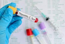 Erradicar la hepatitis C en México es posible; sin embargo hace falta mejorar los programas de detección y prevención, coincidieron especialistas en el tema.