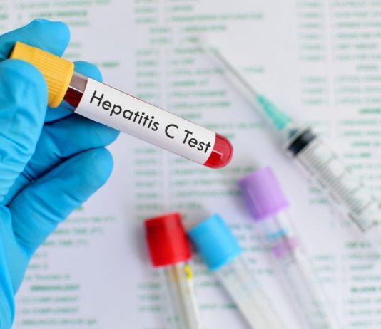 Canadá investiga varios posibles casos de la nueva hepatitis infantil aguda Erradicar la hepatitis C en México es posible; sin embargo hace falta mejorar los programas de detección y prevención, coincidieron especialistas en el tema.