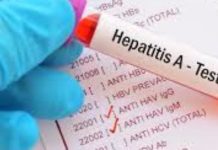 La hepatitis A es una enfermedad contagiosa que generalmente se transmite de persona a persona a través de objetos, alimentos o bebidas.
