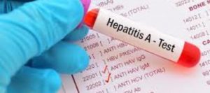 La hepatitis A es una enfermedad contagiosa que generalmente se transmite de persona a persona a través de objetos, alimentos o bebidas.