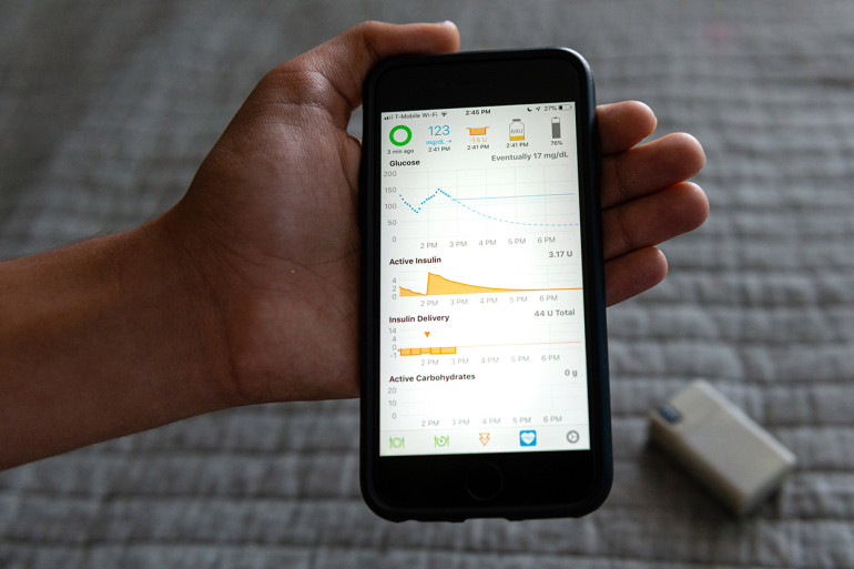Sam monitorea sus niveles de glucosa en su tel&eacute;fono, con la ayuda de una fuente de c&oacute;digo abierto llamada Open Artificial Pancreas System (OpenAPS), conocida en la comunidad de personas con diabetes como &ldquo;looping&rdquo;. (Heidi de Marco/KHN)
