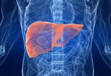 El investigador concluyó que los niveles de colesterol están íntimamente relacionados con la progresión tumoral: entre más colesterol tenemos más progresión y, por tanto, un tumor más agresivo.