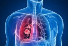 La tasa de mortalidad por cáncer disminuye en Estados Unidos En el total del periodo en estudio, los mayores avances se dieron en las tasas de mortalidad por cáncer de pulmón, que disminuyeron el 51 % en los hombres y el 26 % en las mujeres.