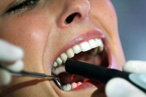 La mala salud bucal est&aacute; relacionada con padecimientos del coraz&oacute;n debido a la propagaci&oacute;n, mediante el torrente sangu&iacute;neo, de bacterias y otros g&eacute;rmenes de la boca