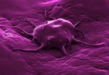Una de cada tres personas fallecerá debido al cáncer en 2025 Una de cada tres personas en el mundo va a morir por algún tipo de cáncer en 2025
