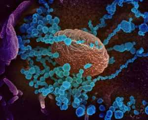 La población debe prepararse ante la inevitable propagación en Estados Unidos del coronavirus COVID-19, que ha causado la muerte a más de 2.600 personas en todo el mundo