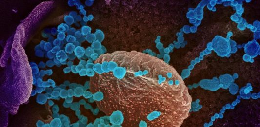 La población debe prepararse ante la inevitable propagación en Estados Unidos del coronavirus COVID-19, que ha causado la muerte a más de 2.600 personas en todo el mundo