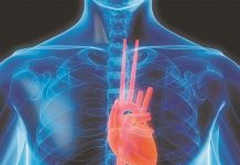 La nutrigenética podría ser una herramienta eficaz que ayude a prevenir Enfermedades No Transmisibles como las enfermedades del corazón, la diabetes y el cáncer
