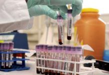 Funcionarios federales han facilitado el proceso para que los laboratorios universitarios y comerciales realicen sus propias pruebas, y están aumentando su capacidad.